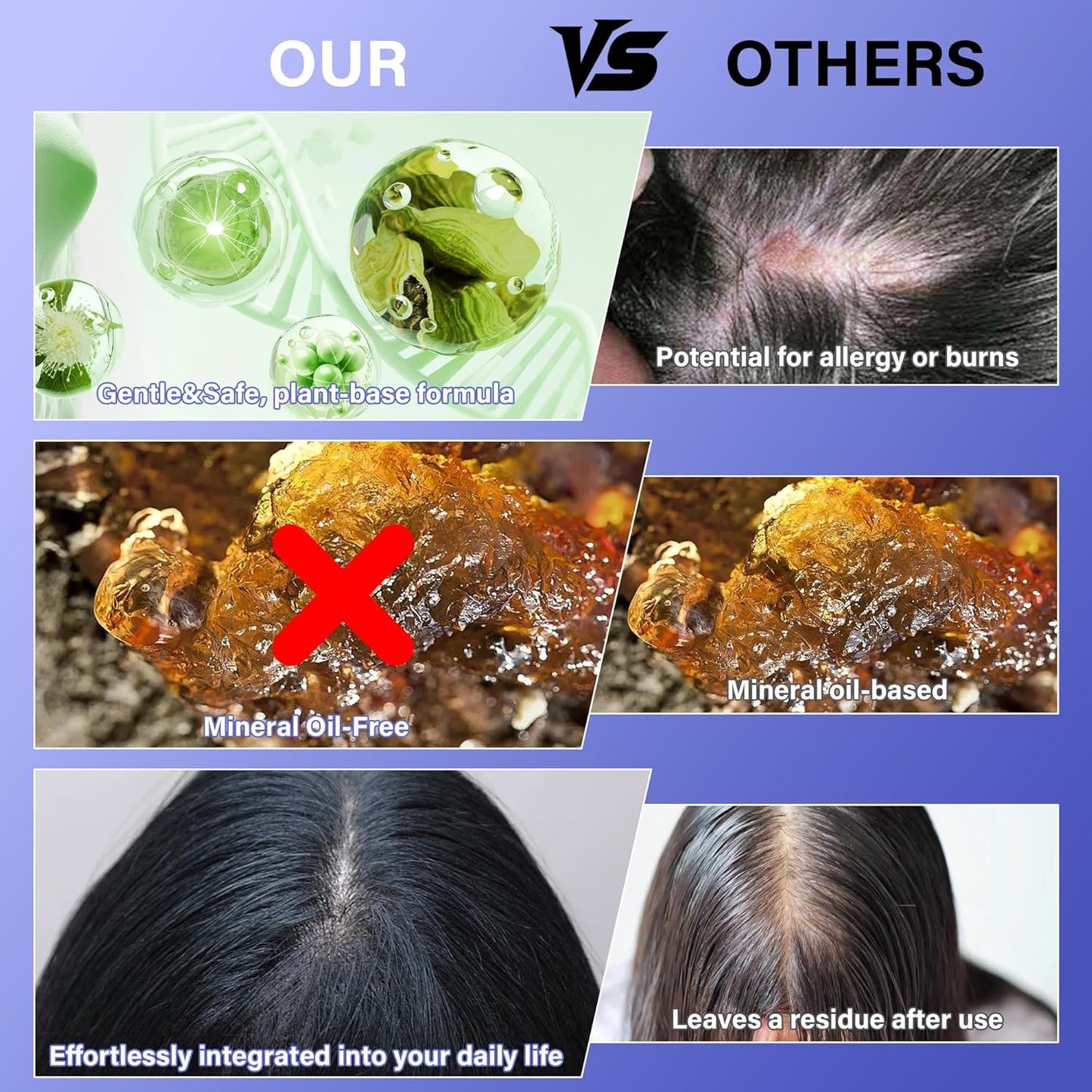 Rosemary Oil for Hair Growth: Hair Scalp Oil with Organic Rosemary Essential Oil, Upgraded Plant-Based Formula to Invigorate Follicles Strengthen Roots and Reduce Loss & Bald Patches
