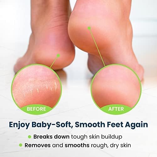 Foot Callus Remover Pedicure Set – Epsom Salt Foot Soak & Callus Remover Gel, Antifungal Cream and Feet Exfoliator for Dead Skin, Pedicure Tools for Feet at Home, Made in USA (4 Piece)