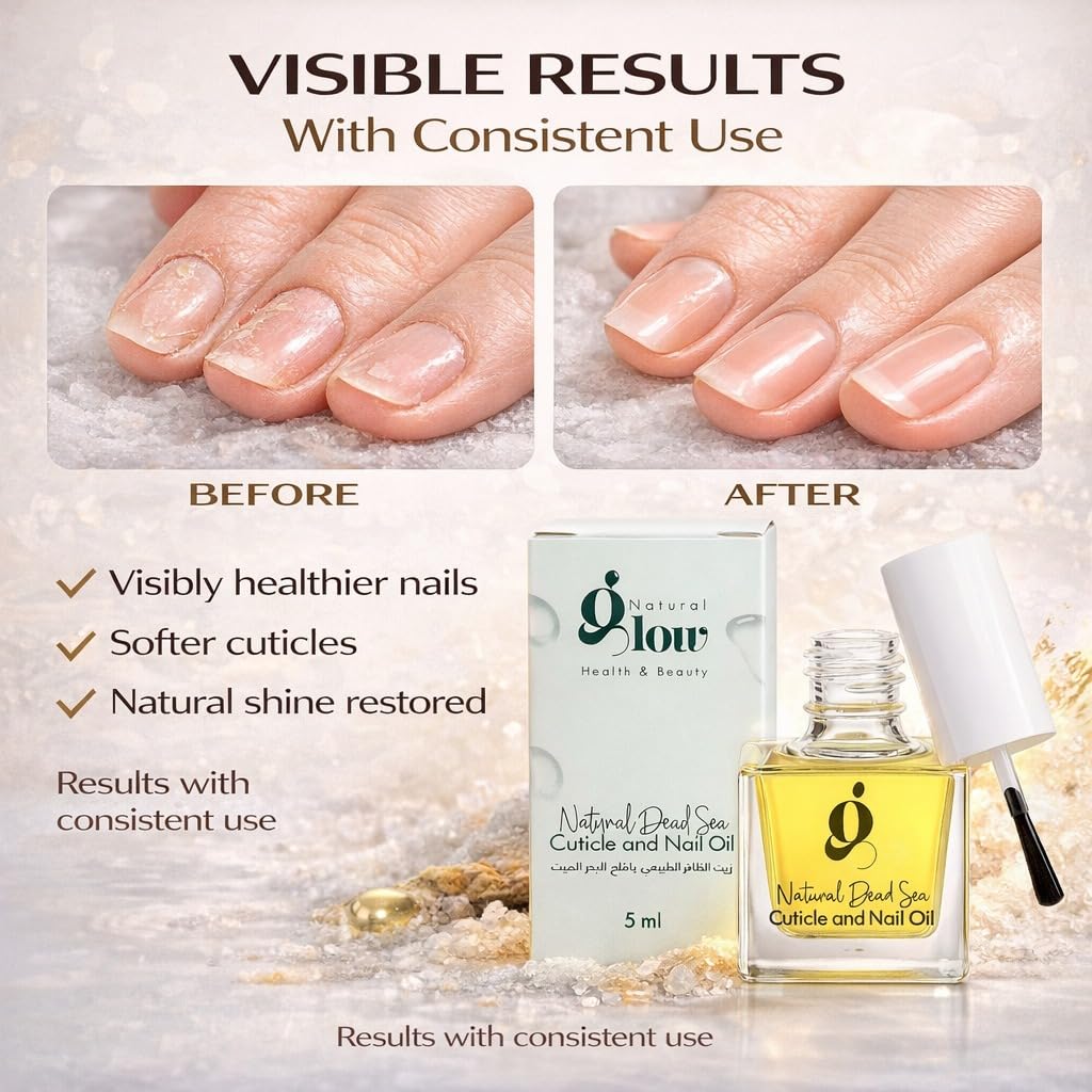 Dead Sea Cuticle & Nail Oil 5ML | Strengthens & Moisturizes Dry & Cracked Cuticles | With Jojoba, Argan, Olive, Almond & Castor Oils, Vitamin E | Nail Repair & Conditioning Oil