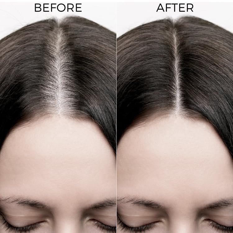 BRILLARE 20% Rosemary Oil Shots For Rapid Hair Growth | Improves Thickness | Controls Hair Fall & Nourishes Scalp | 100% Natural, Non Greasy Hair Oil Shots For Men & Women