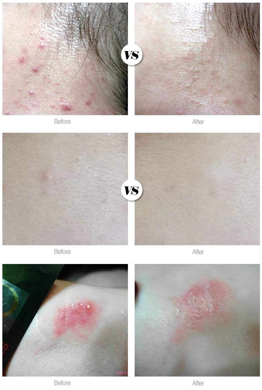 [DAYCELL] Machihyun 20 Calming Ampoule (Roll On) 9ml