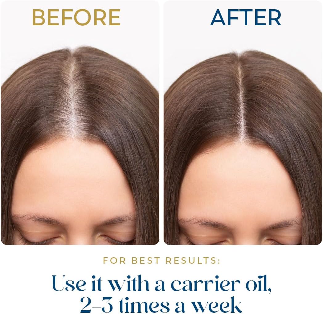 Herbsindia Rosemary Essential Oil for Hair - Huge 3.3 Fl Oz - 100% Pure - Premium Grade with Glass Dropper, Undiluted, Non-GMO