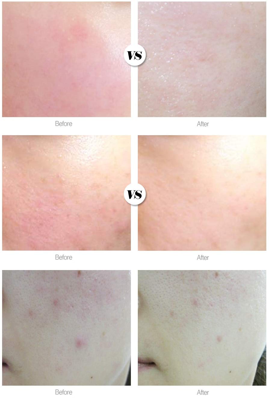 [DAYCELL] Machihyun 20 Calming Ampoule (Roll On) 9ml