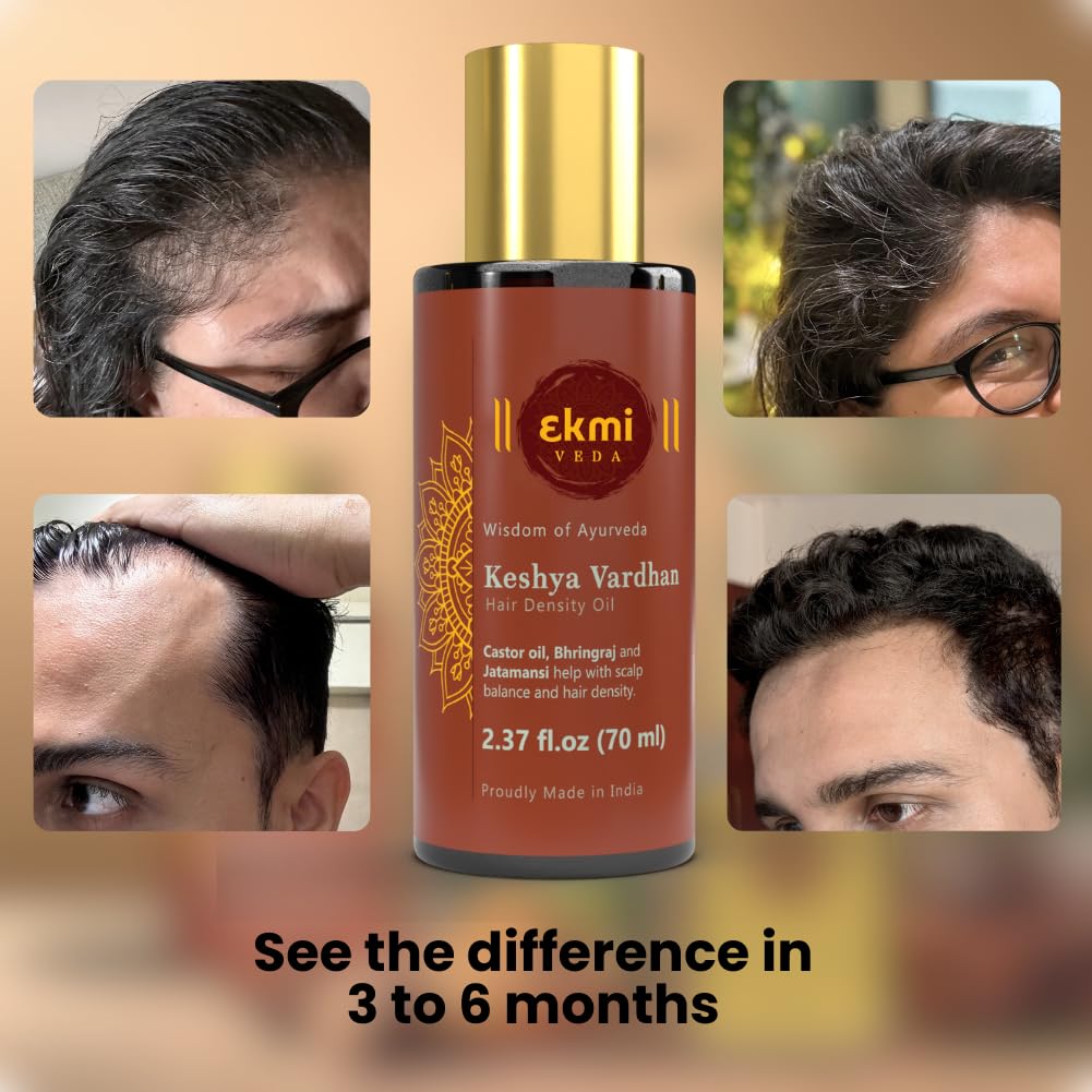 Ayurvedic Castor & Rosemary Oil For Hair Density With Bhringraj, Coconut, Amla, Argan, Brahmi. DHT Blocker. Hair Loss Treatment For Women & Men, 2.37 Fl Oz