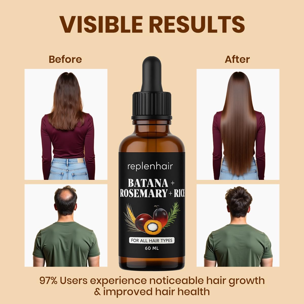 Batana Oil for Hair Growth Oil with Rosemary Castor, 100% Pure, Organic, Cold-Pressed, Unrefined Batana from Honduras by Dr. Sebi - Natural, Vegan, for Strong Roots and Thick Hair, 8oz