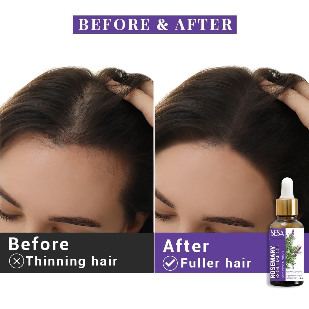Se.sas Rosemary Essential Oil For Hair Growth Nourishes Skin Hair Fall Control Oil For Women and Men 100% Pure & Natural Rosemary 30 ml