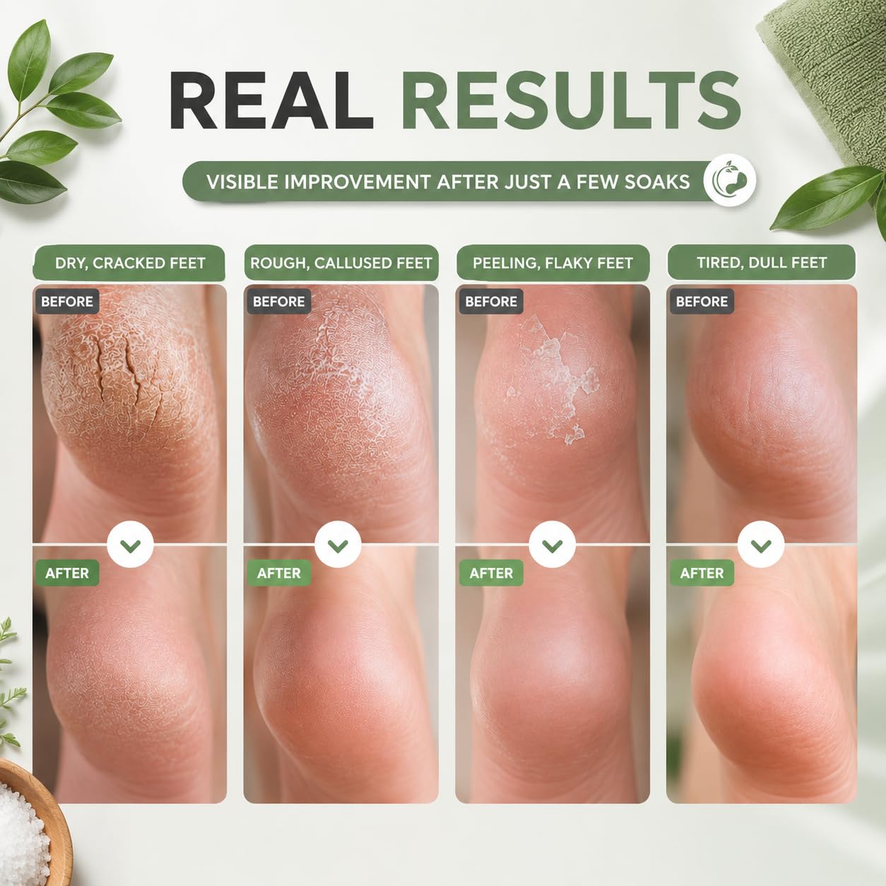 Tea Tree Oil Foot Soak with Epsom Salt, Foot Bath Salt for At-Home Pedicure, Refreshing Foot Soak for Tired Feet, Botanical Oil Blend, 16 oz