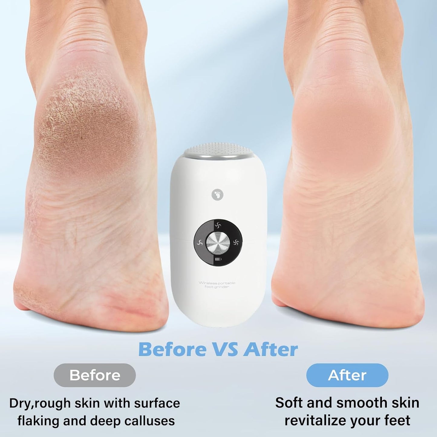 Electric Foot Callus Remover Grinder - Rechargeable Pedicure Tools Callus Remover for Feet Foot Scrubber File Foot Care with 3 Speeds 2 Stainless Grinding Heads for Hard Cracked Dry Dead Skin