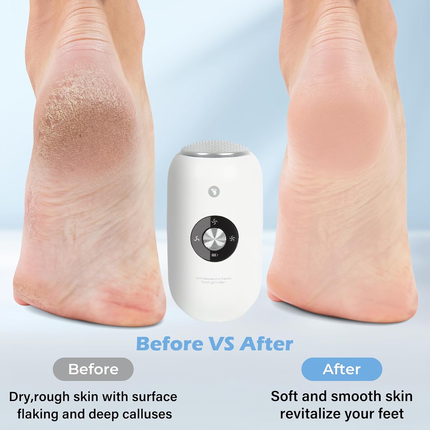 Electric Foot Callus Remover Grinder - Rechargeable Pedicure Tools Callus Remover for Feet Foot Scrubber File Foot Care with 3 Speeds 2 Stainless Grinding Heads for Hard Cracked Dry Dead Skin