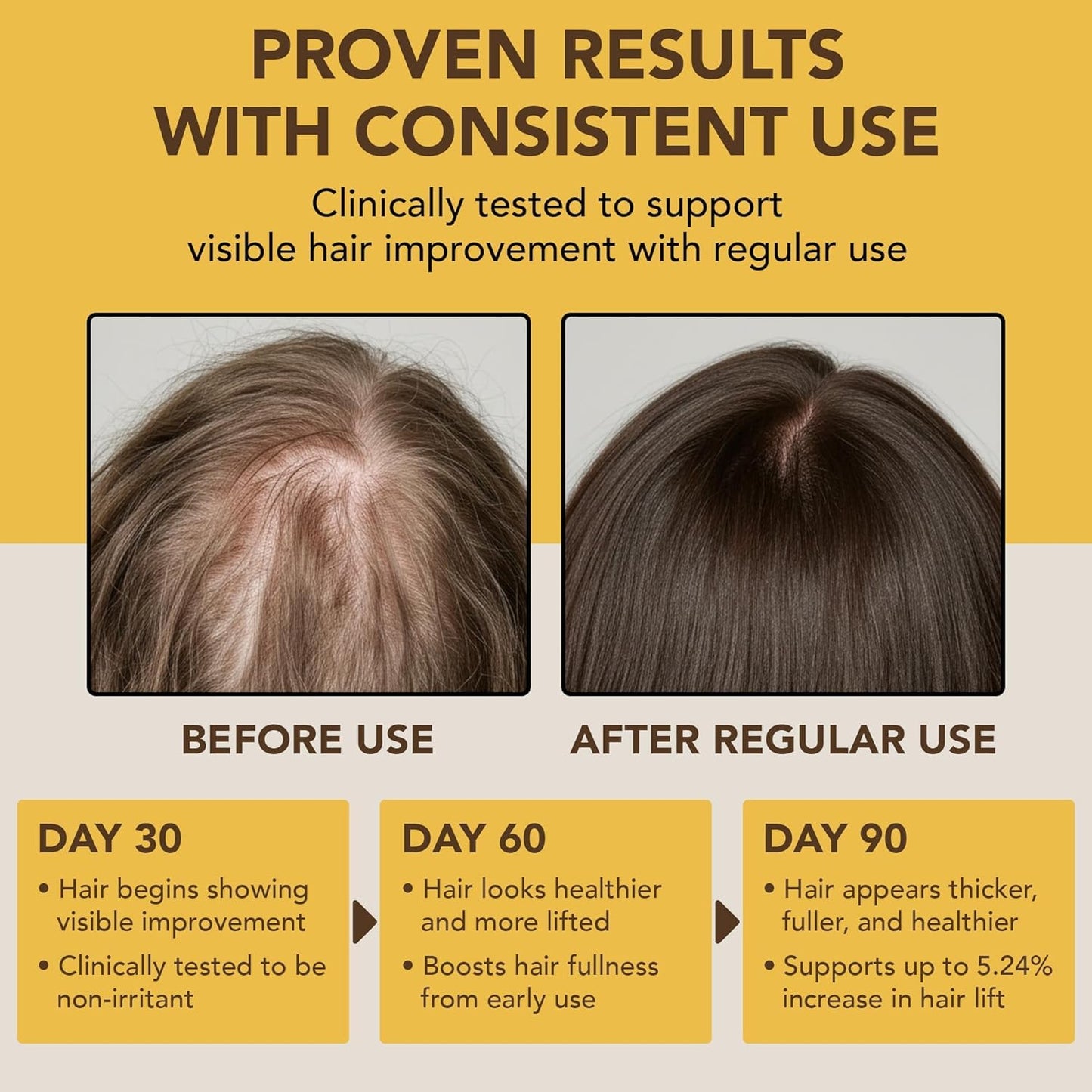 Botanic Hearth Batana Oil for Hair Growth & Hair Treatment Oils 4 Fl Oz | Dr Sebi Inspired, 100% Raw & Pure Batana Oil | Scalp & Hair Treatment for Thickness & Strength | All Hair Types