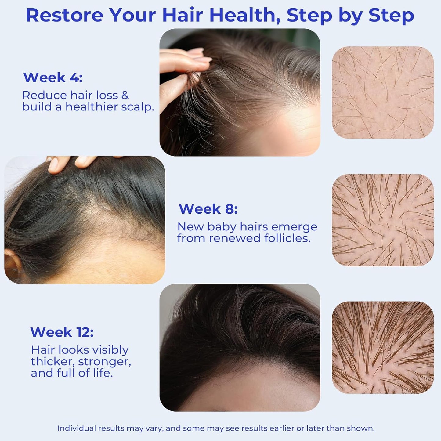 Rosemary Oil Hair Growth Serum Roll On – 3% Rosemary Oil, 2% Caffeine, 2% Niacinamide & DHT Blocking Complex, Non-Greasy Scalp Serum for Men & Women, Designed for Thinning, Fine & Weak Hair, 2-Pack