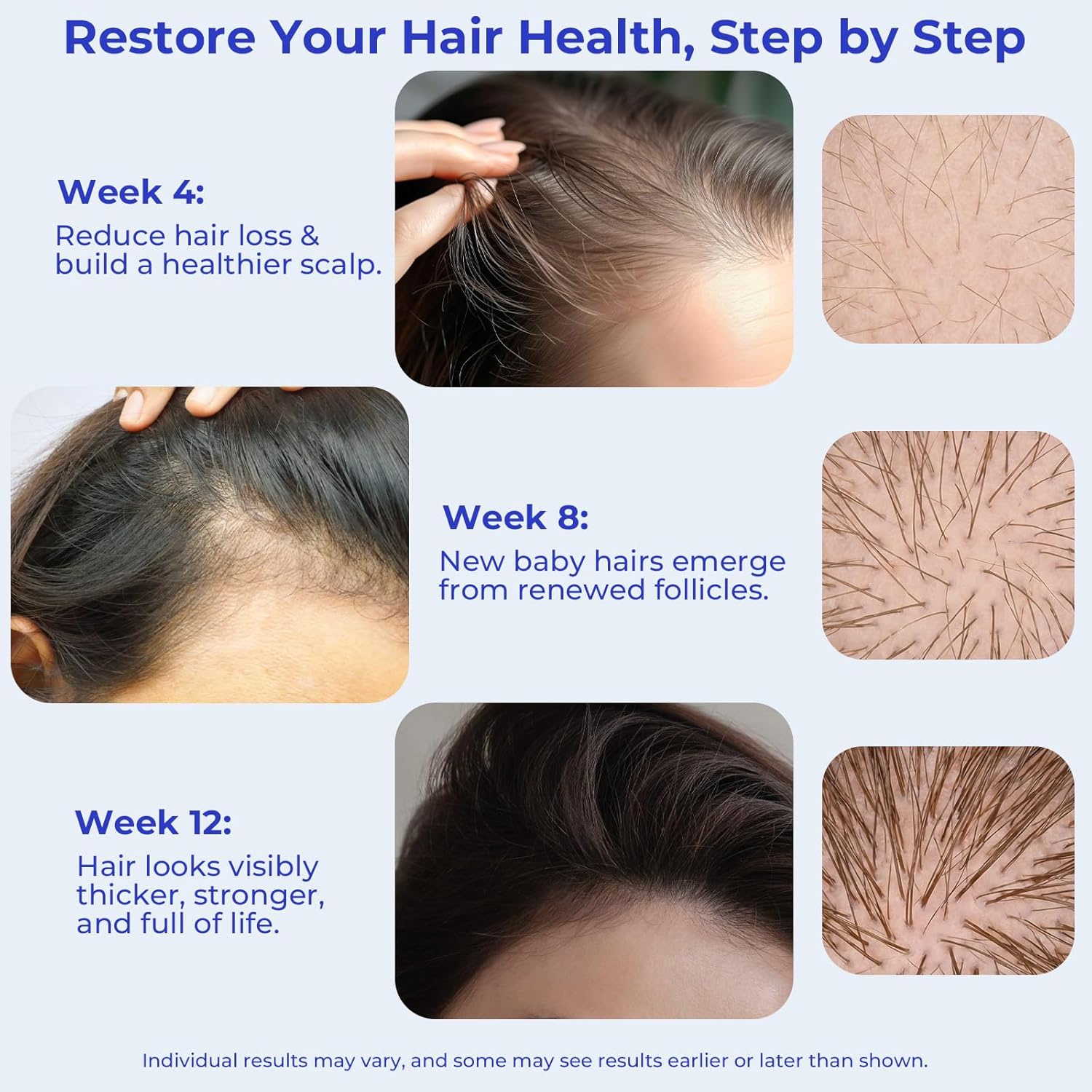 Rosemary Oil Hair Growth Serum Roll On – 3% Rosemary Oil, 2% Caffeine, 2% Niacinamide & DHT Blocking Complex, Non-Greasy Scalp Serum for Men & Women, Designed for Thinning, Fine & Weak Hair, 2-Pack