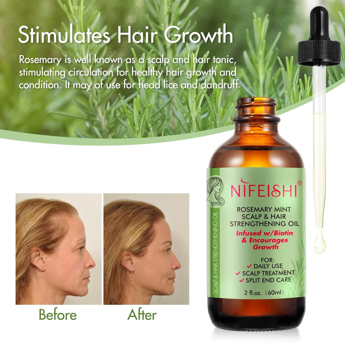 NIFEISHI Rosemary Oil for Hair Growth & Strengthening