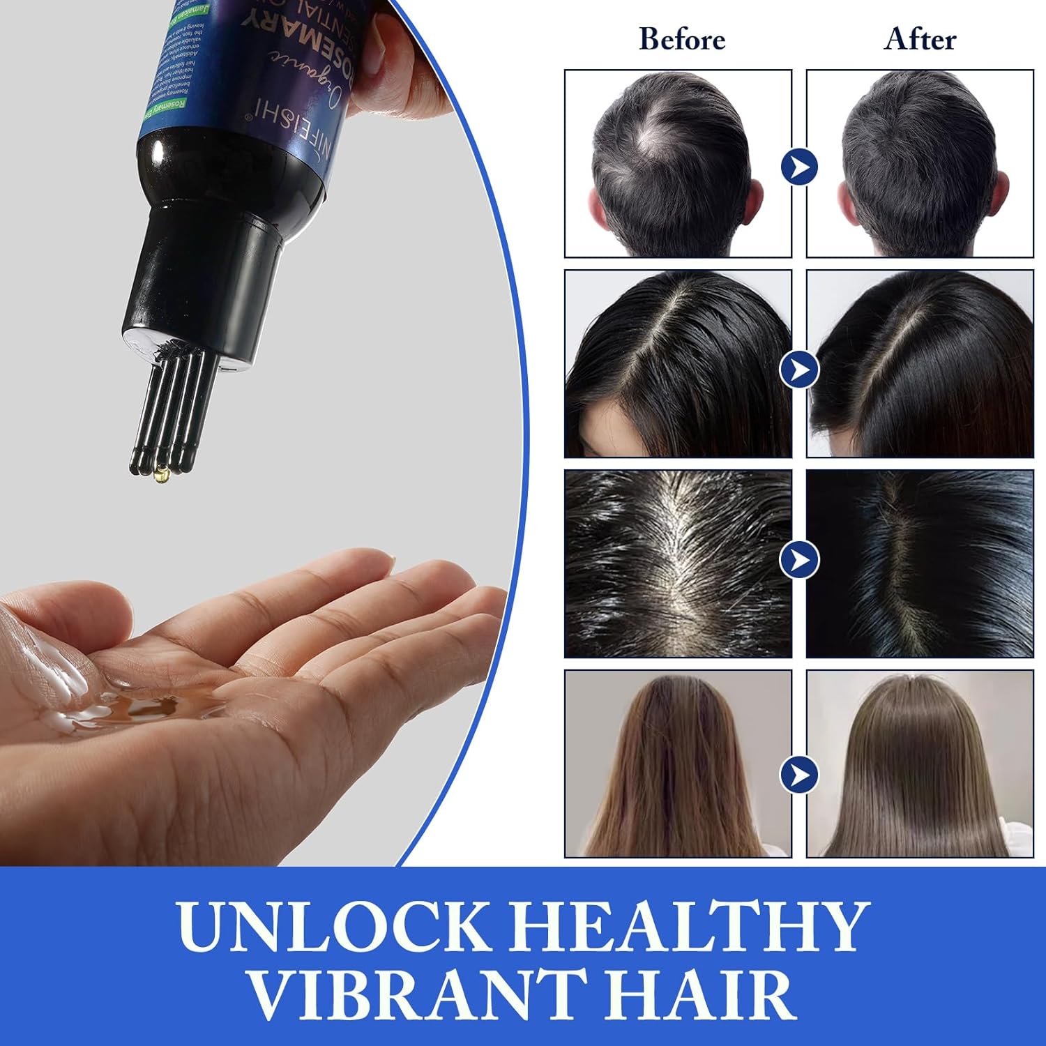 Rosemary Essential Oil for Hair Growth, Scalp Massage and Body - 120ml Pure Organic Infusion with Castor Oil, Improves Blood Circulation, Reduces Hair Loss