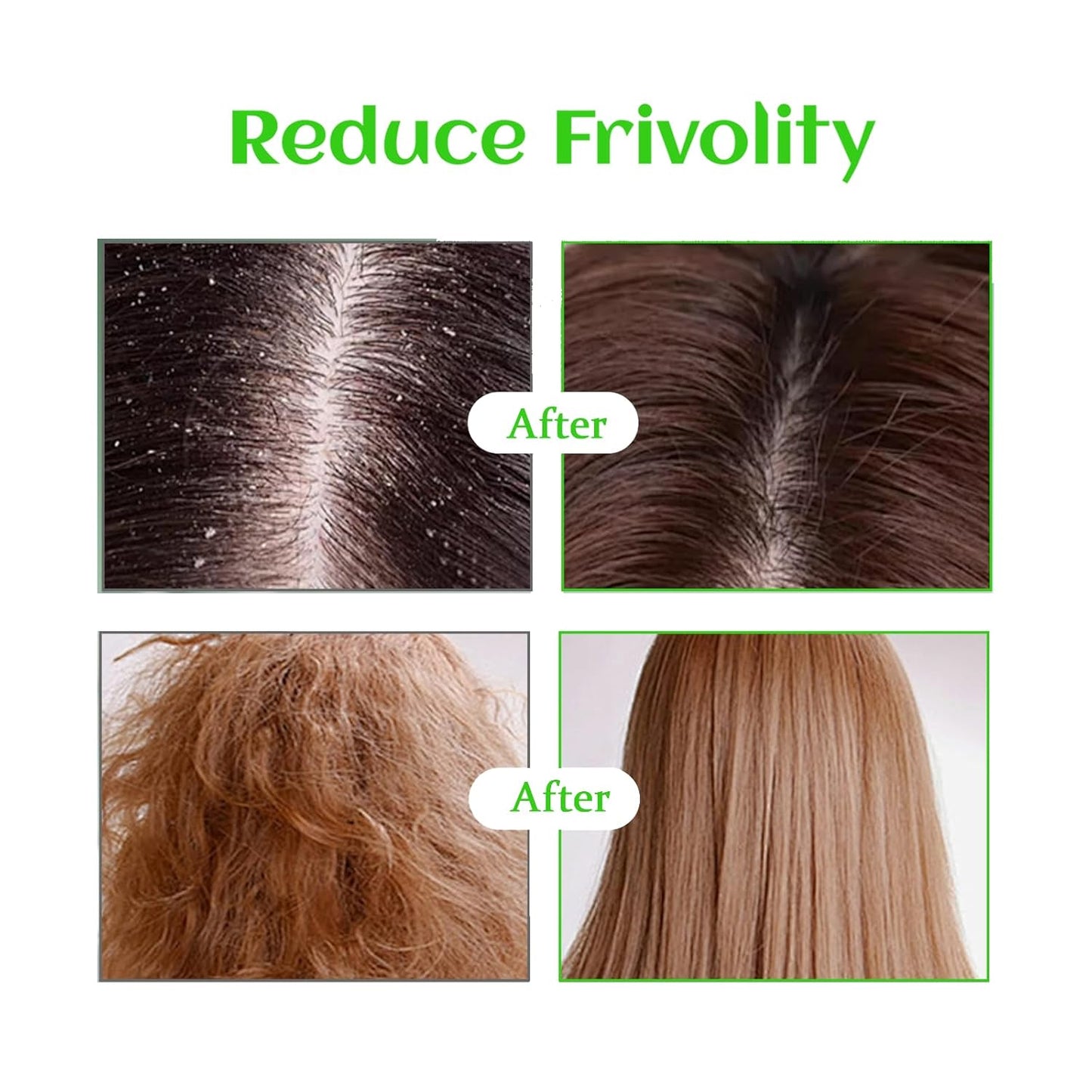 Rosemary Oil for Hair Growth with Castor, USDA Certified Organic Rose Mary Oils Cold Pressed Blend Oil for Thicker Eyebrow, Repair Damaged Hair-0.5 FL OZ