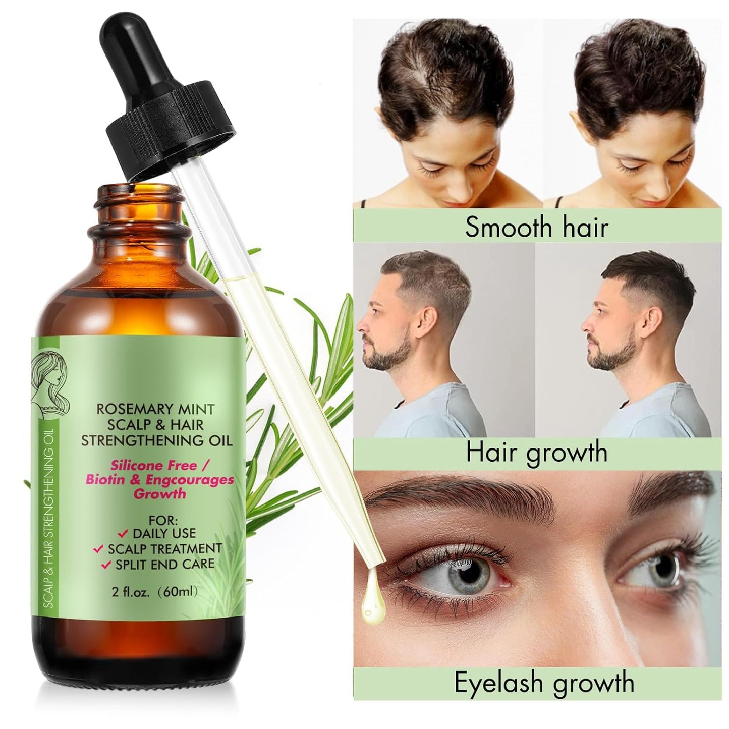 Rosemary Essential Oil (2 Pack), Rosemary Oil for Hair Growth & Skin Care, Face, Dry Scalp Treatment, Hair Growth Serum for Thicker Longer Fuller Healthier Hair
