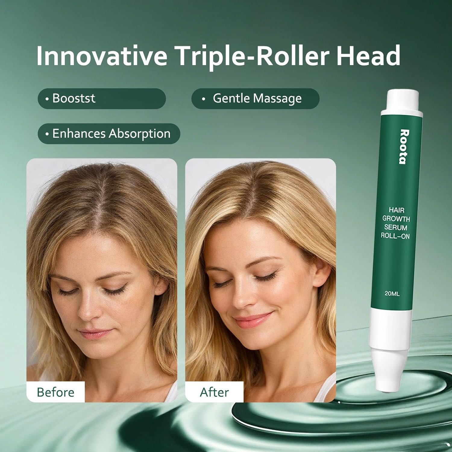 Roota Hair Growth Serum Roll-On, Hair Revival Serum Nourishes Scalp for Thicker, Healthy Hair for Men & Women 20ml/0.68 fl oz