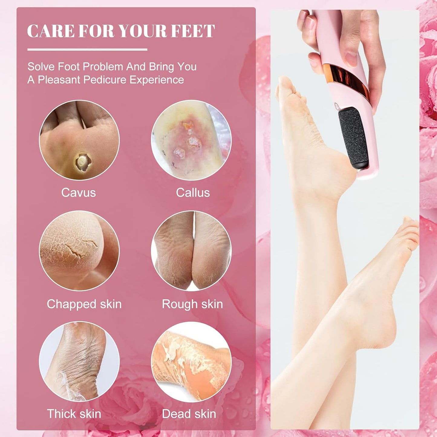 Oneleaf 2 in 1 Electric Callus Remover Shaver Removing Dry, Dead, Hard, Cracked Skin & Callous - Amazing Foot Care Pedicure Tool for Smooth Soft Feet
