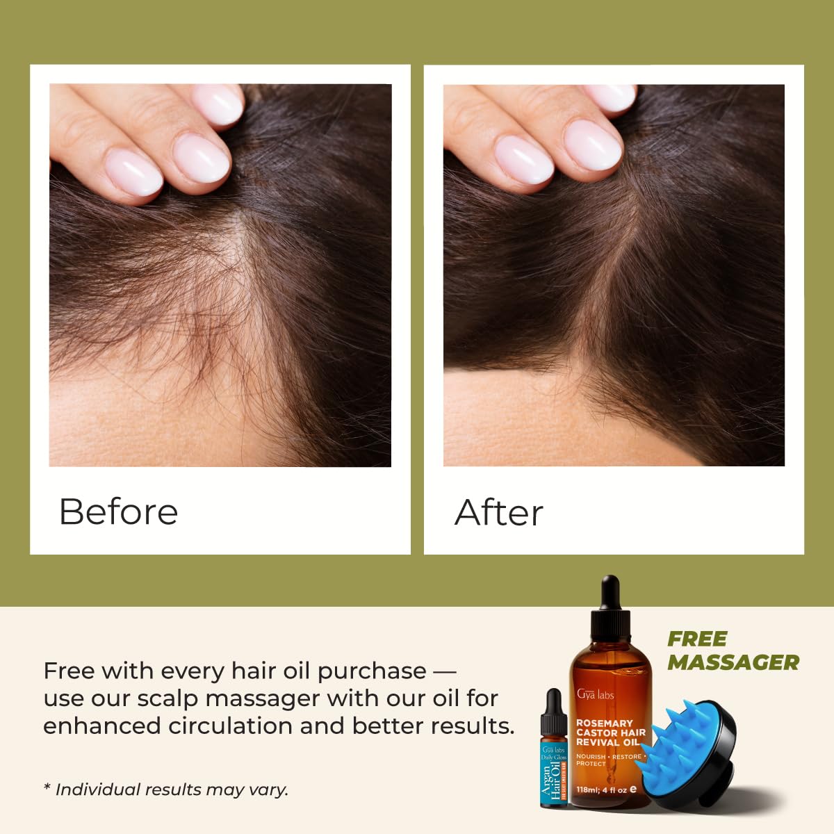 Gya Labs Rosemary & Castor Hair Revival Oil - 4 Fl Oz - Non-Greasy Formula for Thickening & Strengthening - Repairs Damaged Hair, Split Ends & Dry Scalp