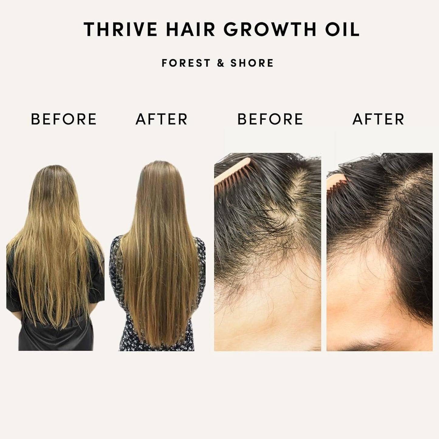 Forest & Shore Hair Growth Oil, 100% Natural, with Caffeine, Biotin, Castor , Argan & Rosemary, Effective Serum for Damaged Hair