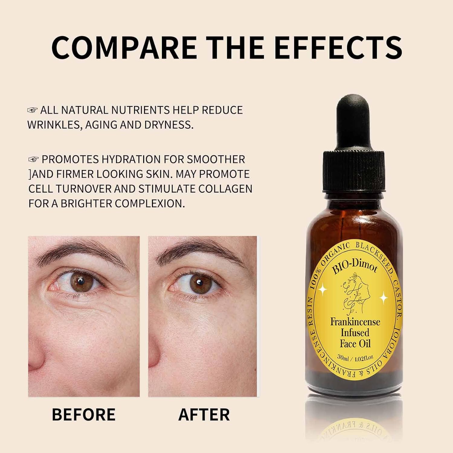 30 ML Frankincense Resin Oil for Face,Castor and Jojoba Oils Anti-Aging Facial Moisturizer Cold Pressed Serum.