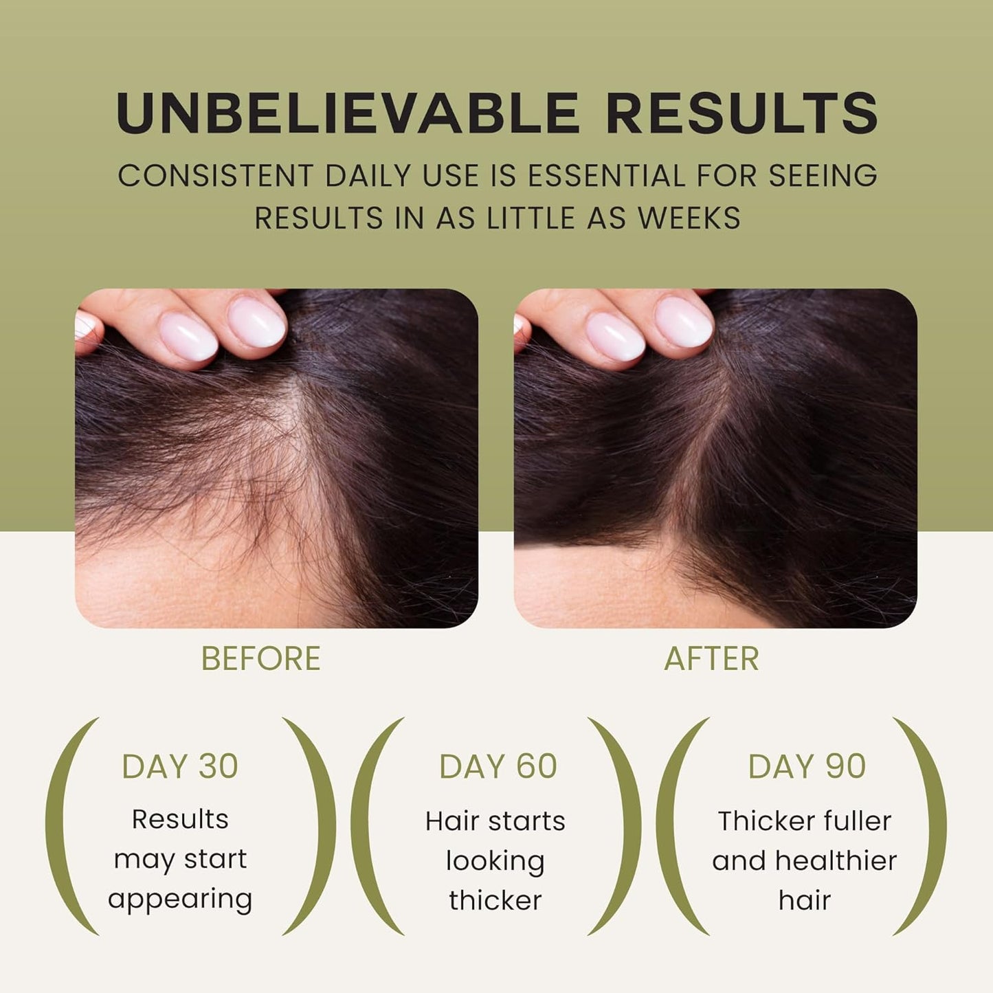 Lebanta Batana Oil For Hair Growth - 100% Pure, Raw & Natural Blend With Organic Castor, Pumpkin Seed, Coconut and Rosemary Oil - Thicker, Stronger Hair Gifts For Men & Women Scalp (1 Pack)