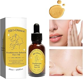 30 ML Frankincense Resin Oil for Face,Castor and Jojoba Oils Anti-Aging Facial Moisturizer Cold Pressed Serum.