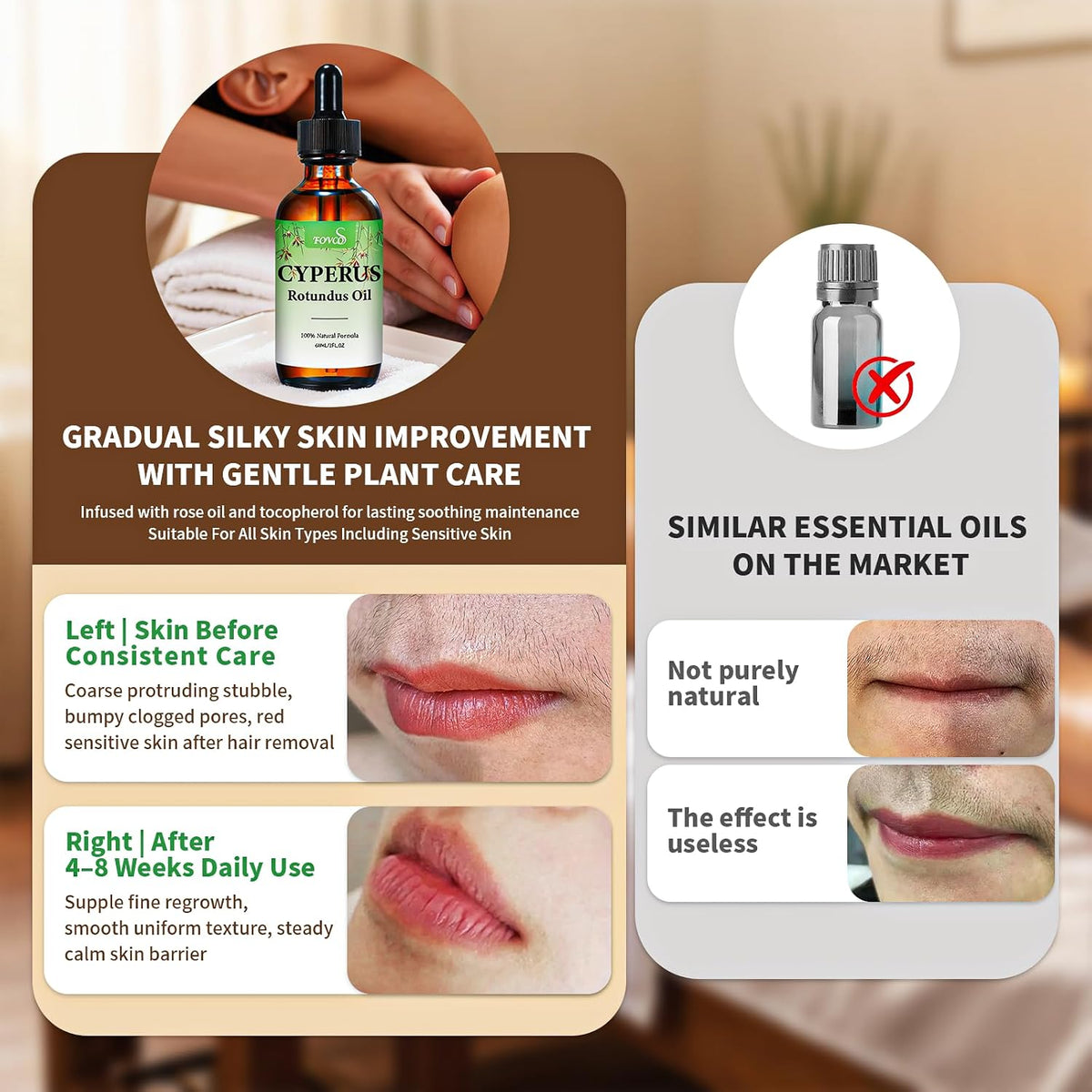 100% Pure Cyperus Rotundus Oil with Sweet Almond &amp; Rosehip – Natural Hair Removal Care &amp; Post-Waxing Soothing Oil for Face, Body, Underarms