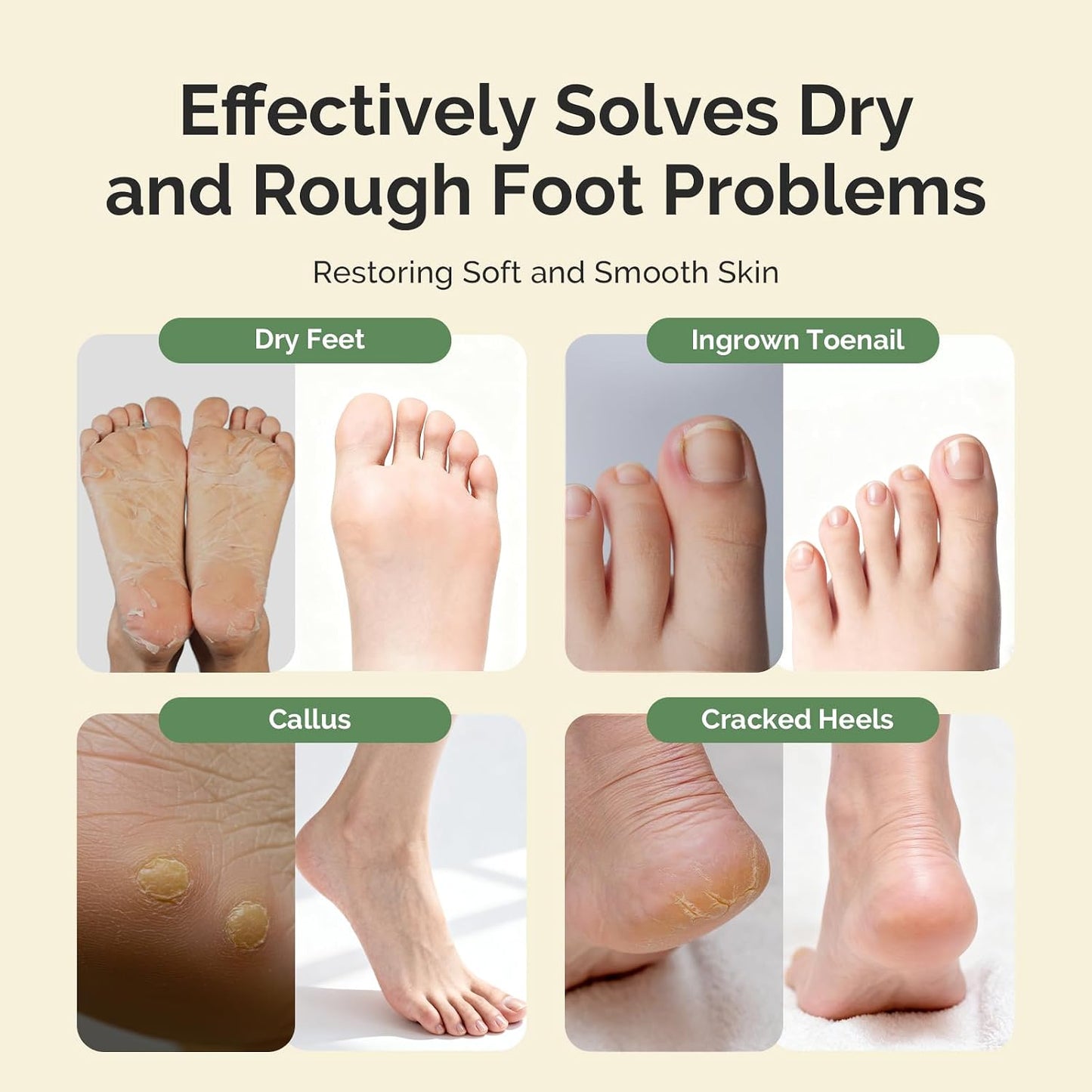 MelodySusie Tea Tree Oil Foot Soak with Sea Salt - Moisturizing Pedicure Treatment for Softening Calluses & Soothing Tired Feet - 16oz Relaxing Foot Bath to Refresh & Rejuvenate 1 Pound