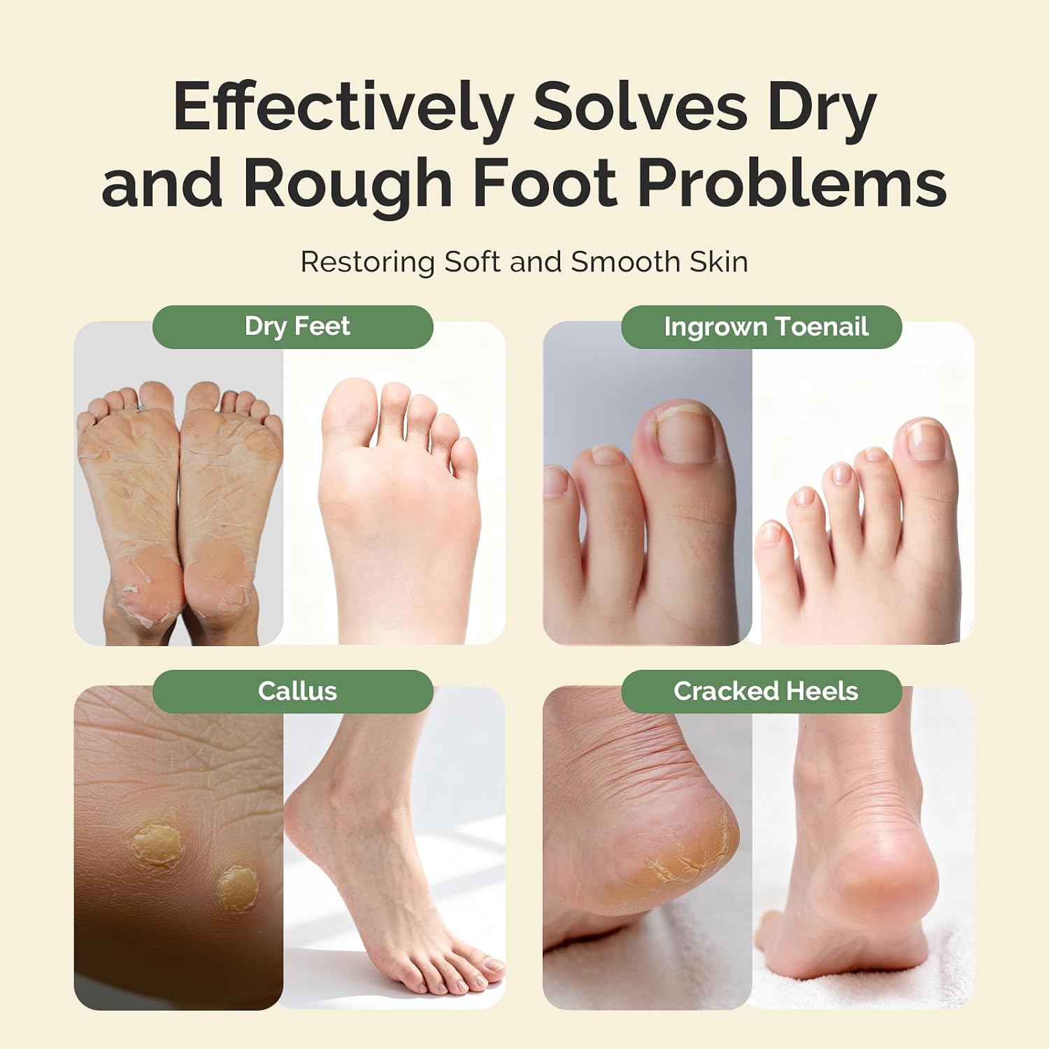 MelodySusie Tea Tree Oil Foot Soak with Sea Salt - Moisturizing Pedicure Treatment for Softening Calluses & Soothing Tired Feet - 16oz Relaxing Foot Bath to Refresh & Rejuvenate 1 Pound