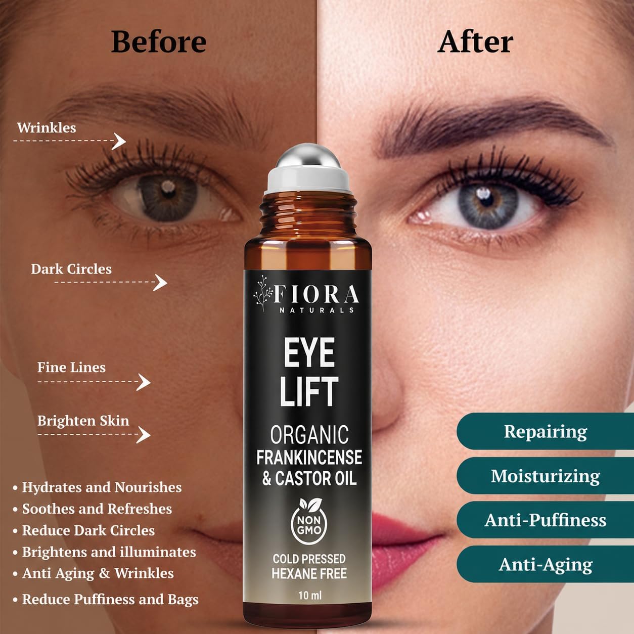 Organic Castor Oil and Frankincense Roll On – 100% Pure Hexane Free Eye Oil for Under Eye, Reduces Wrinkles, Dark Circles & Puffiness, Frankincense Essential Oil for Face Roller by Fiora Naturals