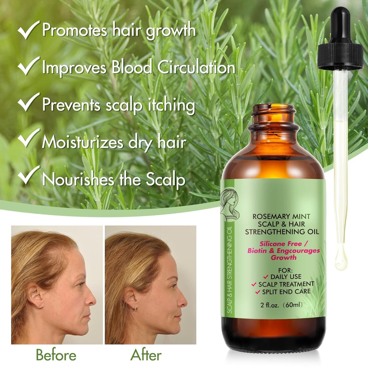 Rosemary Essential Oil (2 Pack), Rosemary Oil for Hair Growth & Skin Care, Face, Dry Scalp Treatment, Hair Growth Serum for Thicker Longer Fuller Healthier Hair