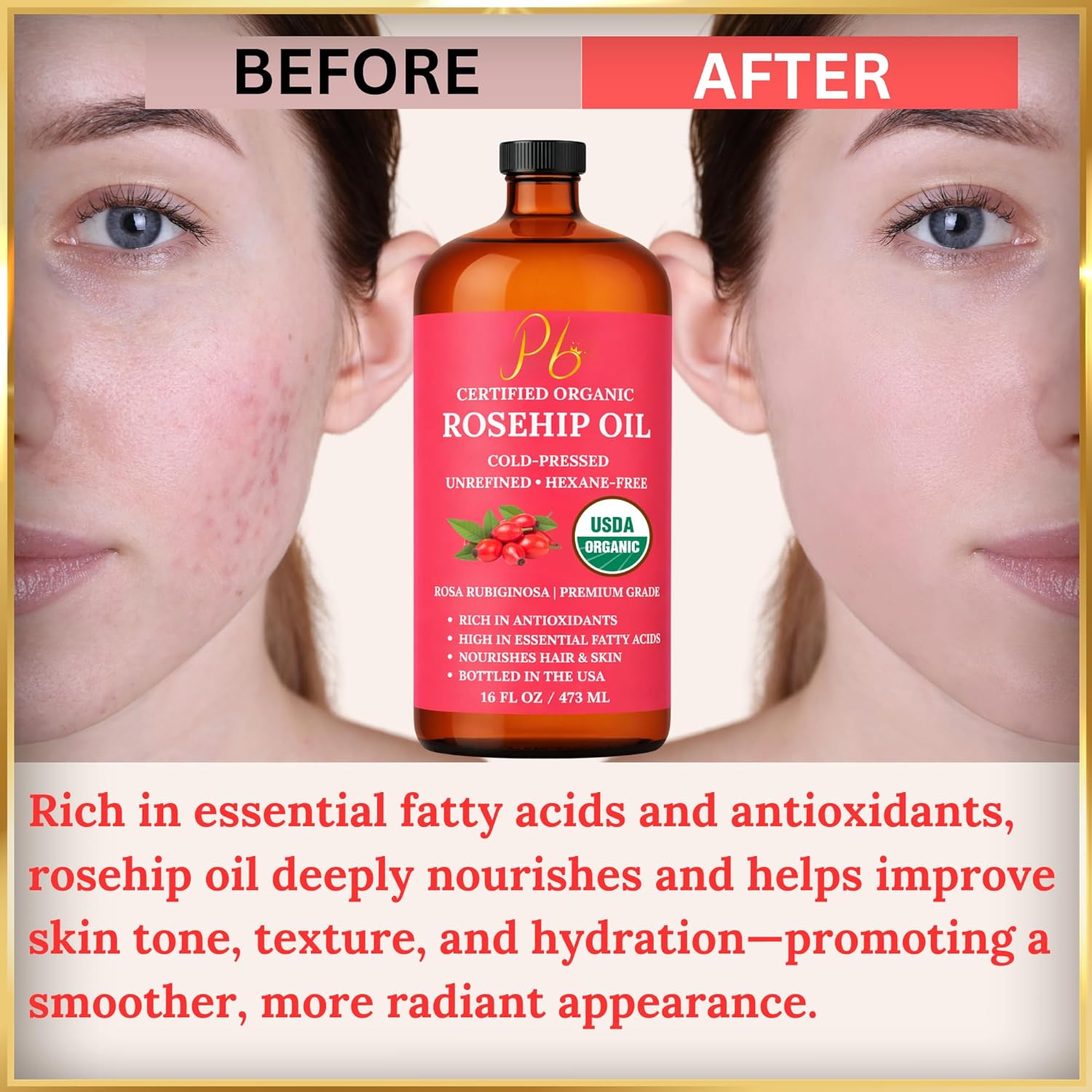 Rosehip Oil – USDA Organic 100% Pure, Cold-Pressed & Unrefined, Rosehip Oil for Face, Skin & Hair– Helps Reduce the Appearance of Fine Lines & Wrinkles – Rose Hip Seed Oil16 fl oz Glass Bottle