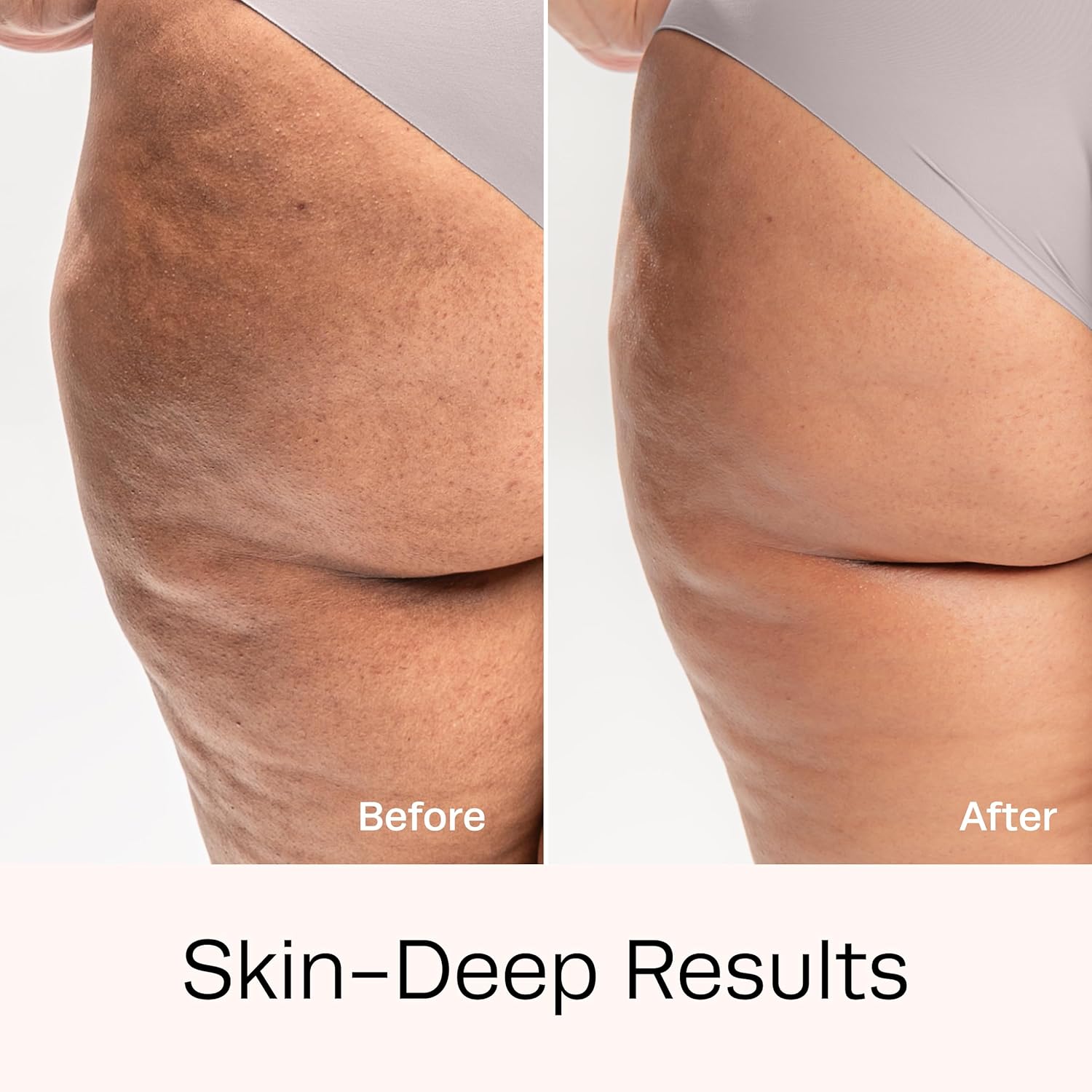 Hot Vita Retinol Toner – Roll-On Oil with Retinol for Smoother, Firmer-Looking Skin – Targeted Care for Belly, Thighs, Arms & Legs – Helps Improve Texture and Appearance