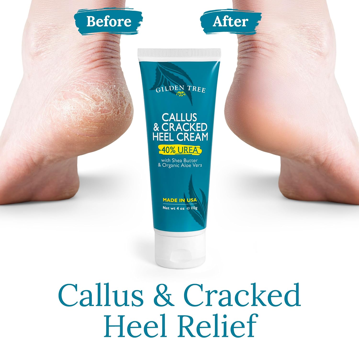 Breathe Easy Shower Steamers + Callus & Cracked Heel Cream with 40% Urea, Shea Butter and Organic Aloe Vera