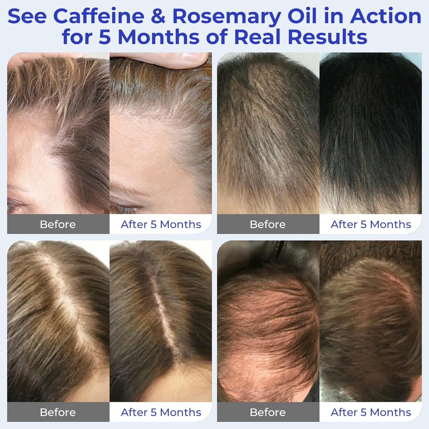 Rosemary Oil Hair Growth Serum Roll On – 3% Rosemary Oil, 2% Caffeine, 2% Niacinamide & DHT Blocking Complex, Non-Greasy Scalp Serum for Men & Women, Designed for Thinning, Fine & Weak Hair, 2-Pack