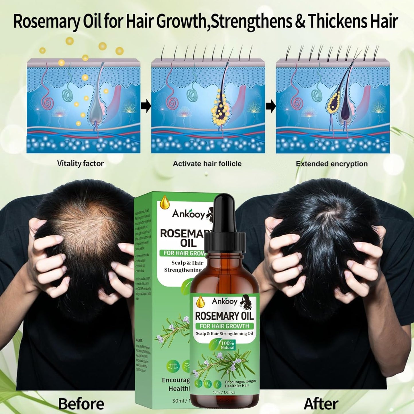 3 Pack Rosemary Oil for Hair Growth,Rosemary Hair Growth Oil,Strengthening Oil for Dry Damaged Hair,Hair Loss Treatment & Thickens Hair,Scalp Care Promotes Hair Thickness for Men Women