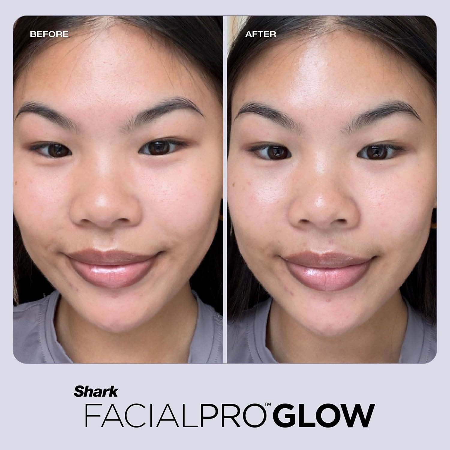 Shark FacialPro Glow at-Home Hydro-Powered Facial System with DePuffi Hot & Cold Therapy – Professional Spa Skincare Device for Pore Cleansing, Hydration, & Radiant Glow, Lilac, FH320PL