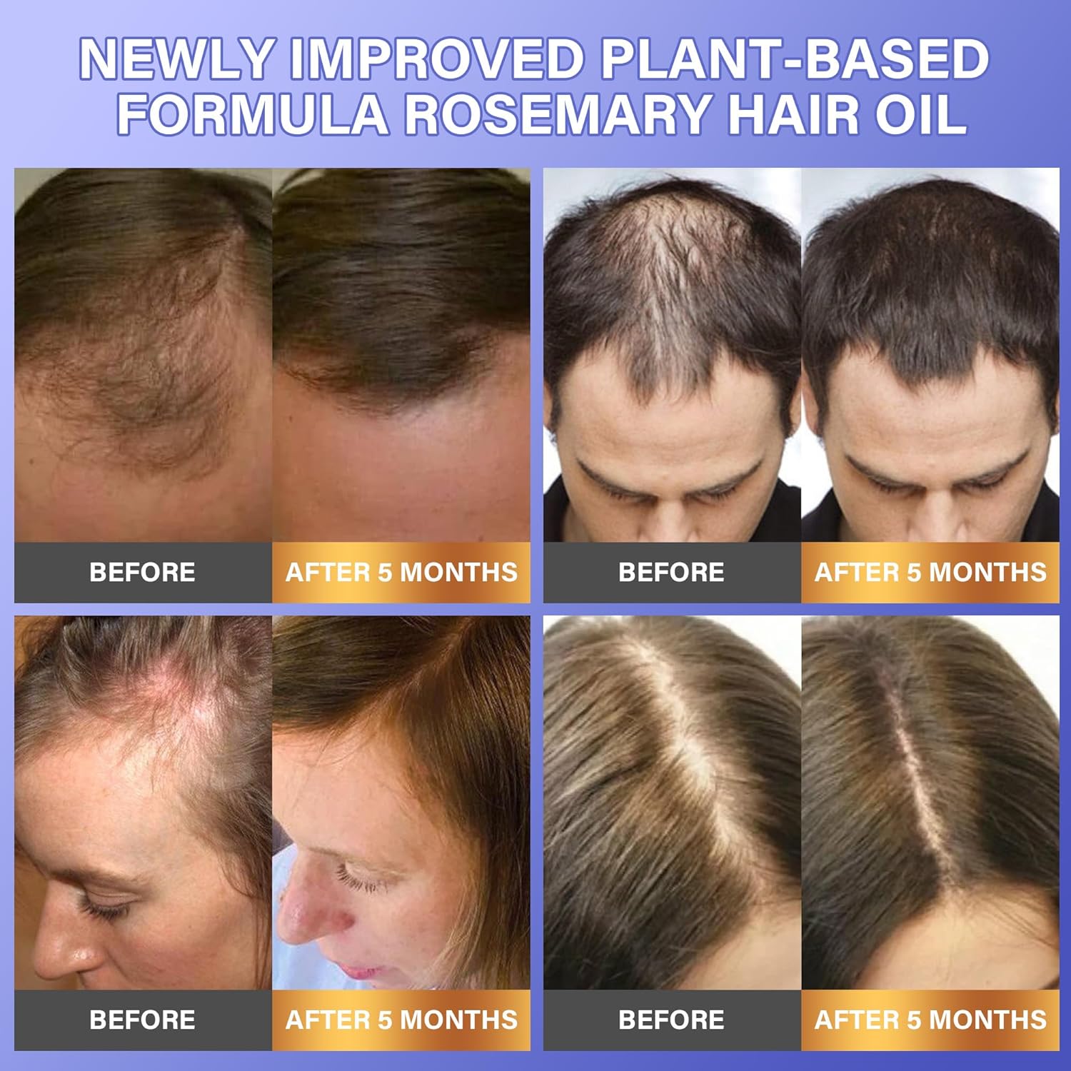 Rosemary Oil for Hair Growth: Hair Scalp Oil with Organic Rosemary Essential Oil, Upgraded Plant-Based Formula to Invigorate Follicles Strengthen Roots and Reduce Loss & Bald Patches
