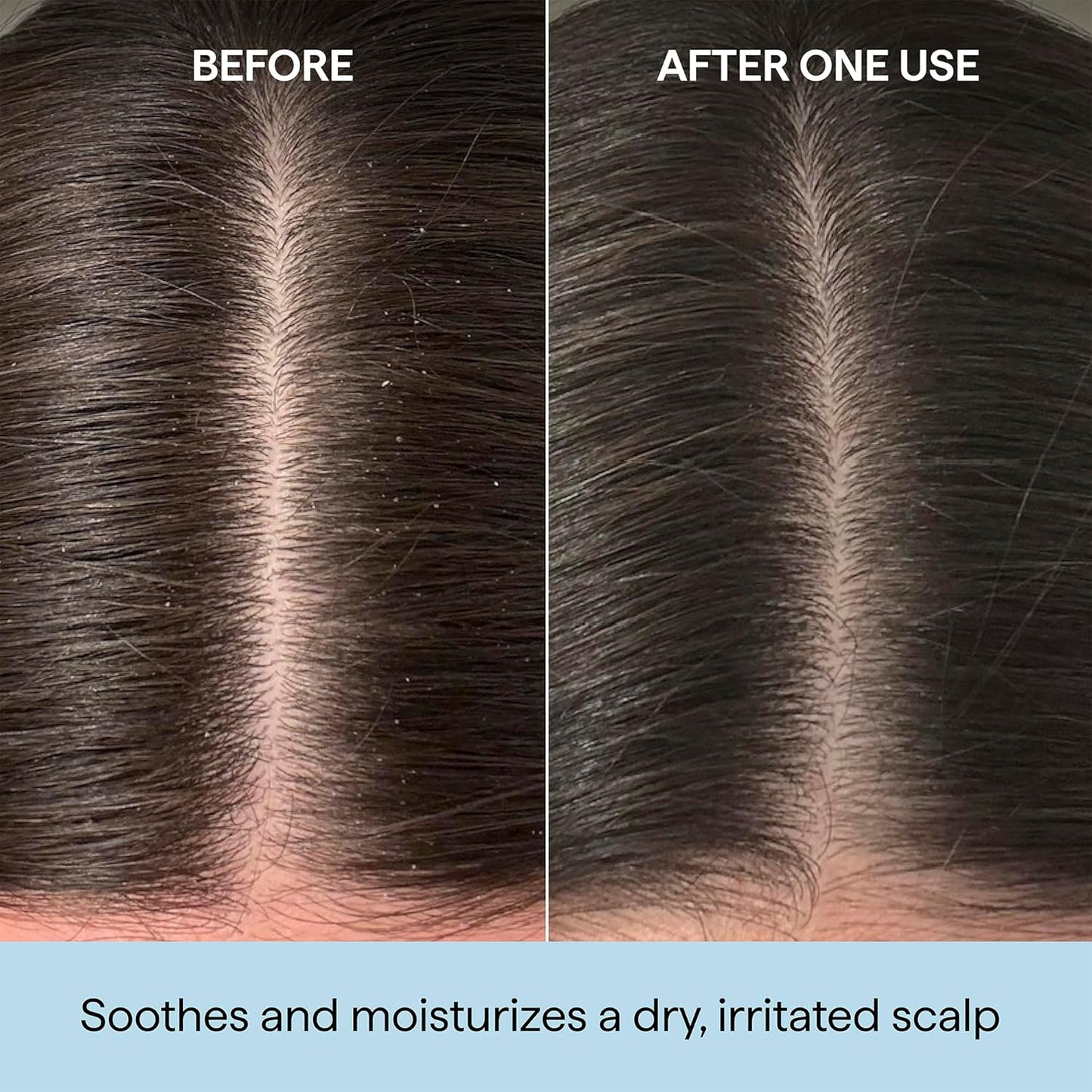 Briogeo Scalp Revival Rosemary Pre-Wash Oil | Moisturizing Scalp Treatment for Dry, Flaky, or Itchy Scalp | Strengthens Hair & Soothes Scalp | Vegan & Cruelty-Free