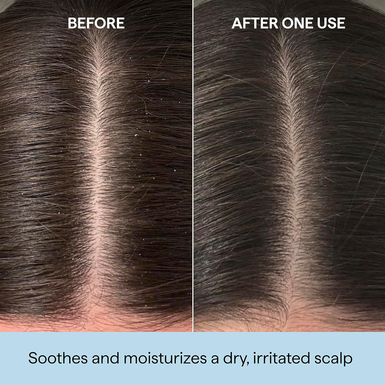 Briogeo Scalp Revival Rosemary Pre-Wash Oil | Moisturizing Scalp Treatment for Dry, Flaky, or Itchy Scalp | Strengthens Hair & Soothes Scalp | Vegan & Cruelty-Free