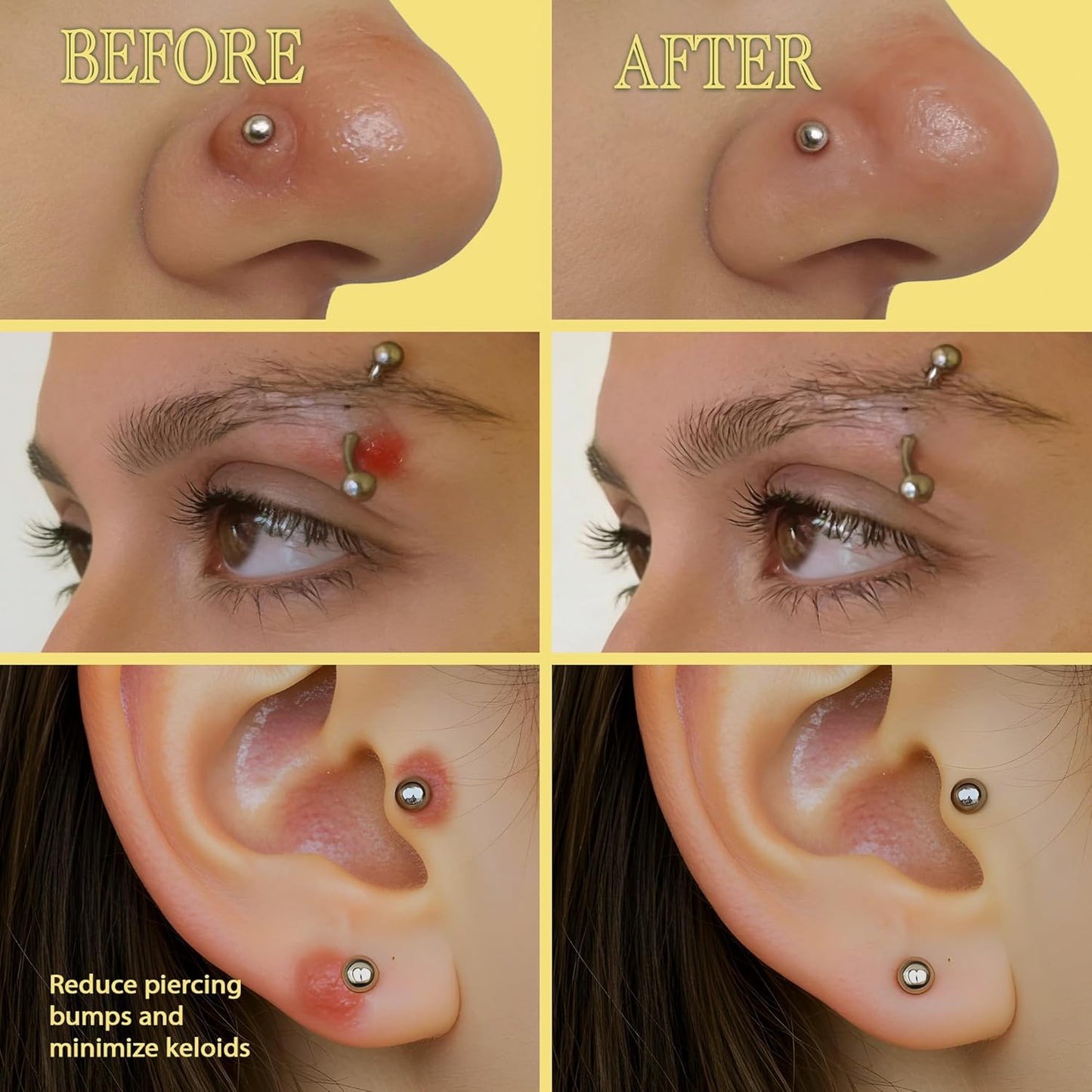 BodyJ4You Keloid Bump Removal Oil - Piercing Aftercare Shrinking Drops - Nose Ear Septum Belly Cartilage Scar Treatment Piercing Bump Solution - Tea Tree Jojoba Essential Oils Keloid Care - 0.33 Fl Oz