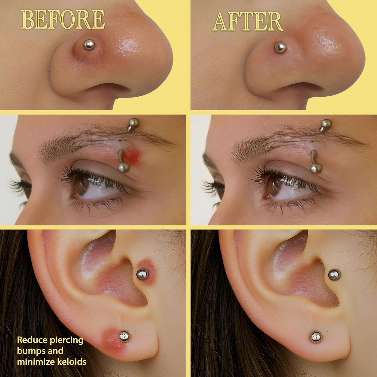 BodyJ4You Keloid Bump Removal Oil - Piercing Aftercare Shrinking Drops - Nose Ear Septum Belly Cartilage Scar Treatment Piercing Bump Solution - Tea Tree Jojoba Essential Oils Keloid Care - 0.33 Fl Oz