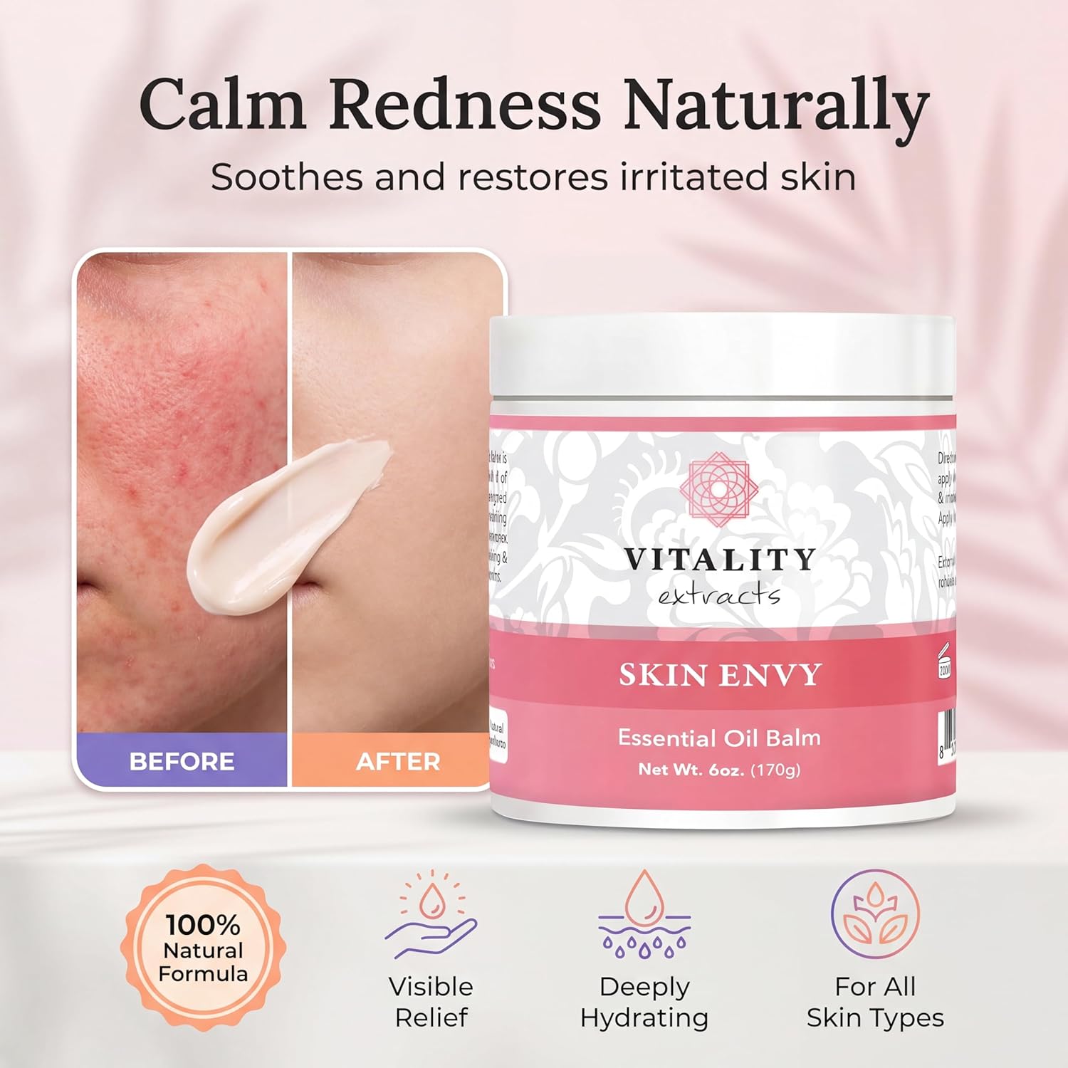 Vitality Extracts Skin Envy Essential Oil Balm - 6oz, Moisturizer, Beeswax, Vitamin A, Skin Care, All Natural, Coconut Oil