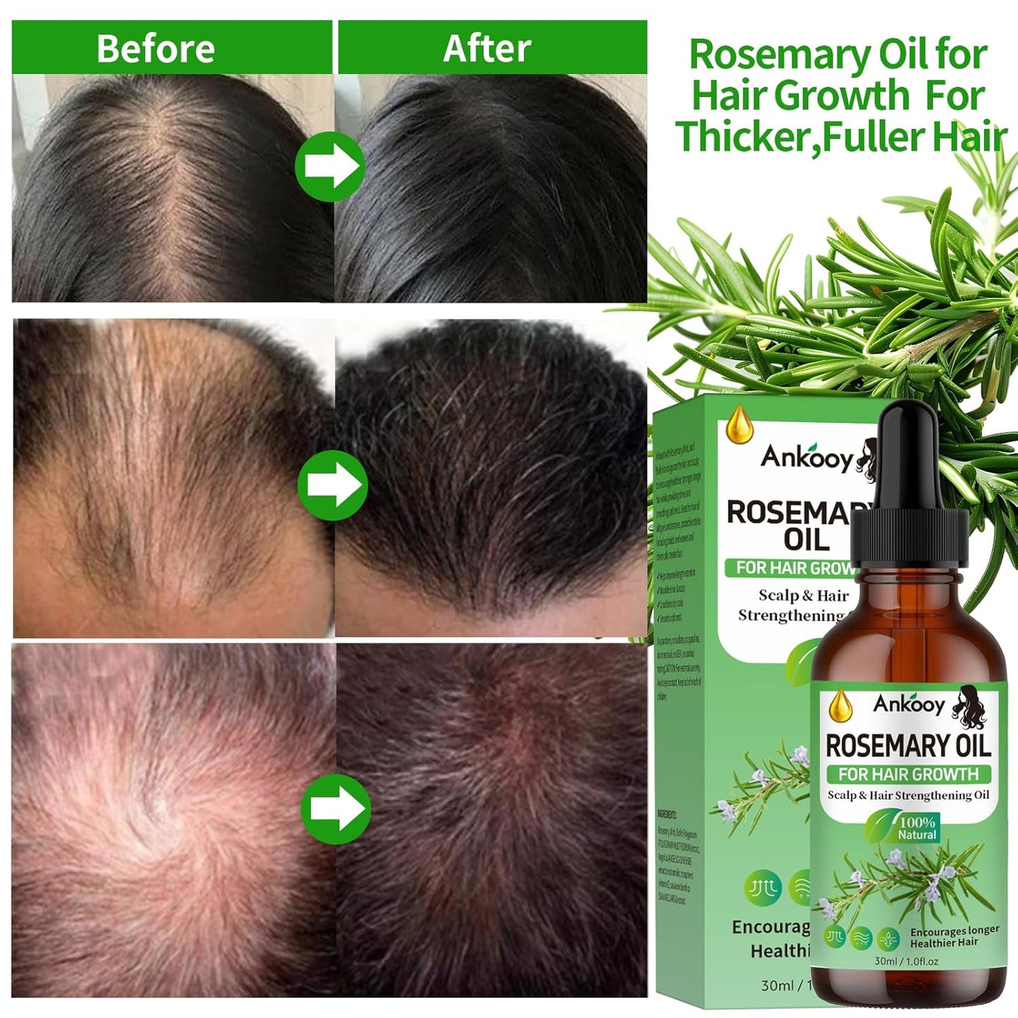 3 Pack Rosemary Oil for Hair Growth,Rosemary Hair Growth Oil,Strengthening Oil for Dry Damaged Hair,Hair Loss Treatment & Thickens Hair,Scalp Care Promotes Hair Thickness for Men Women