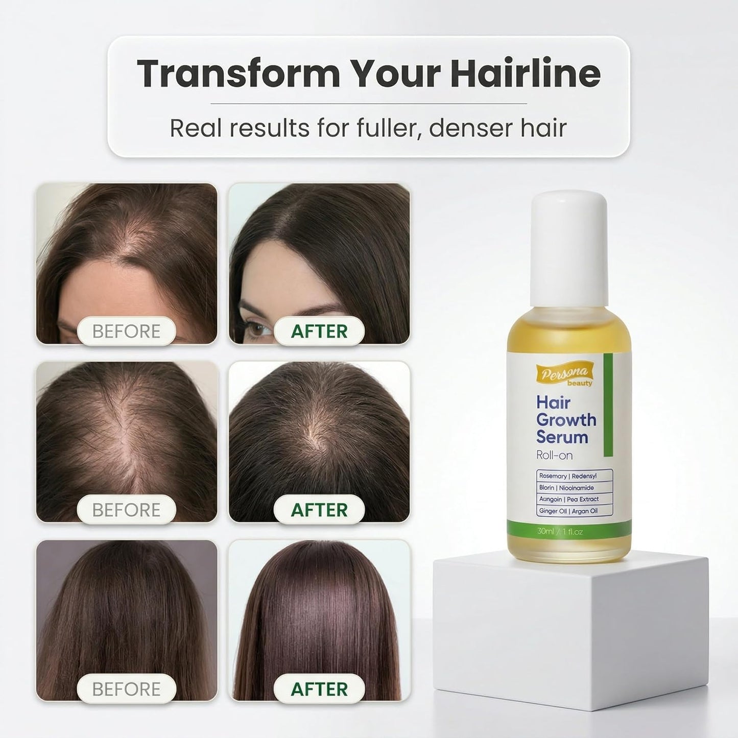 Hair Growth Serum Roll On, Scalp Roller Serum with Precision Applicator for Men and Women, Non-Greasy Formula, Supports Healthier Looking Hair, Targets Thin Edges, Bald Spots & Weak Roots 30ml