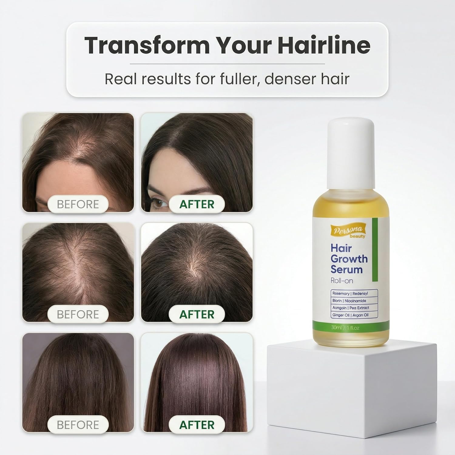 Hair Growth Serum Roll On, Scalp Roller Serum with Precision Applicator for Men and Women, Non-Greasy Formula, Supports Healthier Looking Hair, Targets Thin Edges, Bald Spots & Weak Roots 30ml
