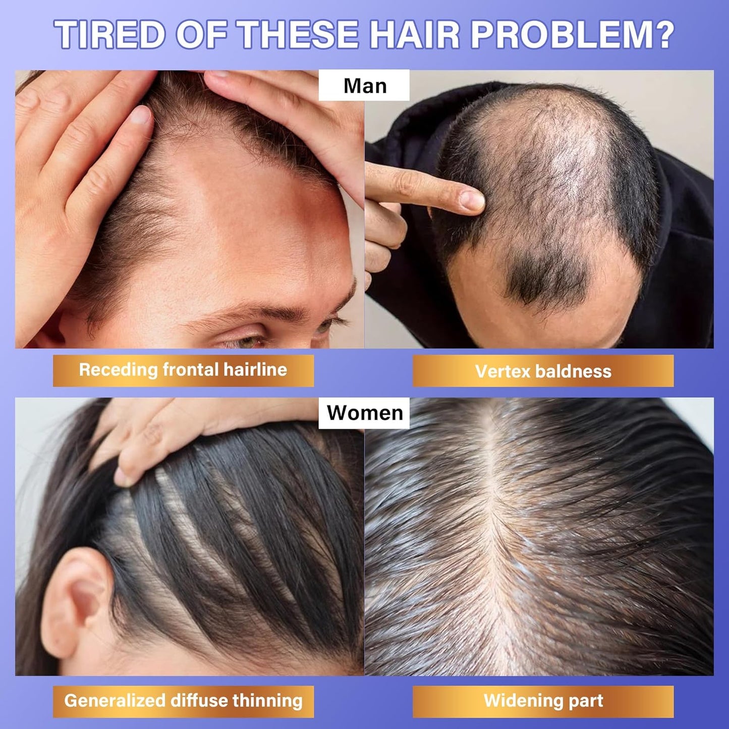 Rosemary Oil for Hair Growth: Hair Scalp Oil with Organic Rosemary Essential Oil, Upgraded Plant-Based Formula to Invigorate Follicles Strengthen Roots and Reduce Loss & Bald Patches