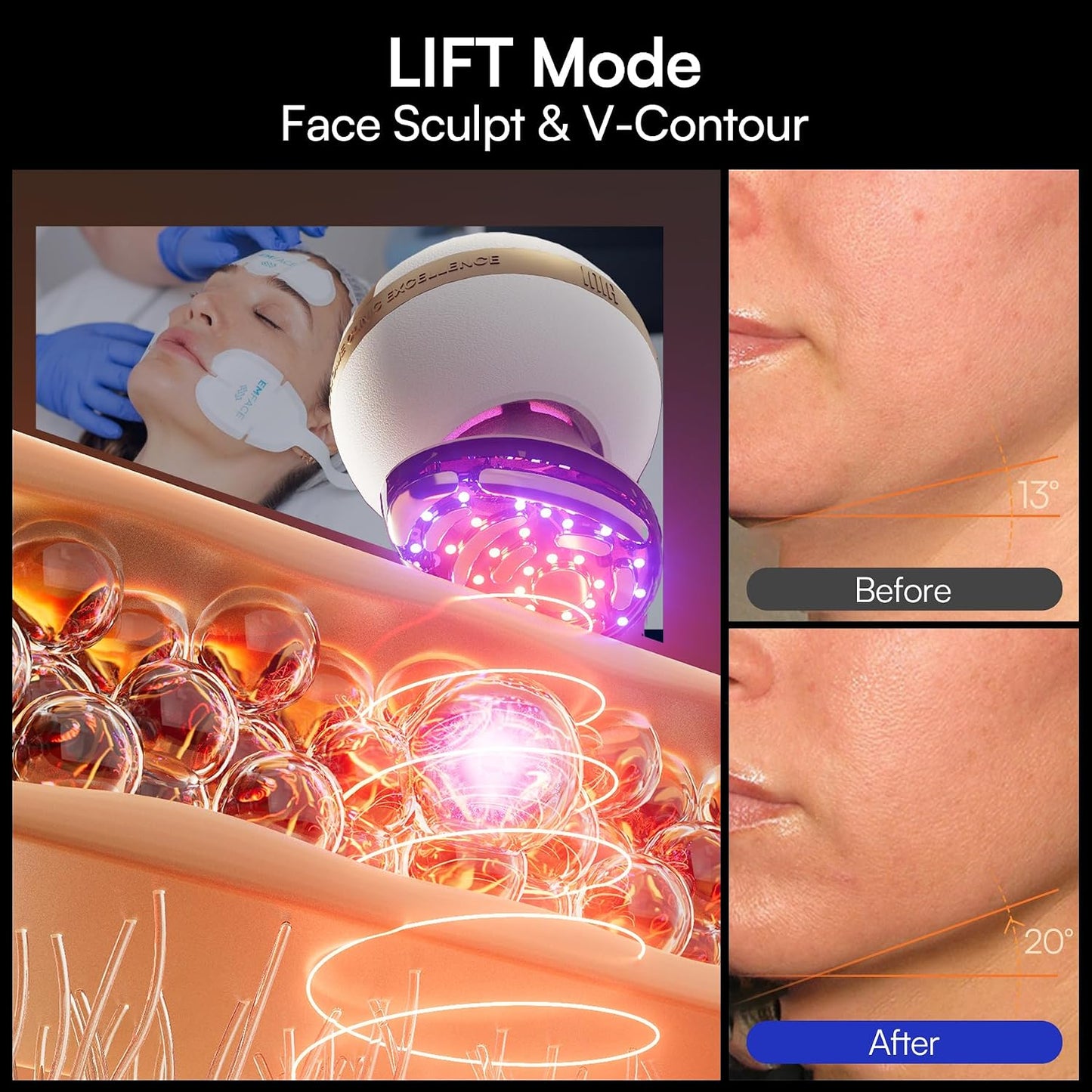 INIA SPHERA Upgraded 8-in-1 Microcurrent Facial Device for Face & Neck – Red Light, Thermal & Cooling Beauty Tool, 5 Custom Modes, At-Home Skin Stimulation & Glow Care Skincare Tool